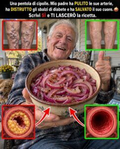 Quel barattolo di cipolle amare ti colpisce le arterie prima di colazione
