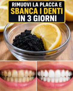 Metodi naturali per ottenere un sorriso più luminoso e riparare i denti soggetti a carie