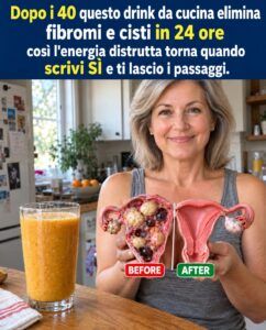 Dopo i 40 anni, i fibromi uterini e le cisti ovariche ti rubano le energie: questa bevanda casalinga li contrasta.