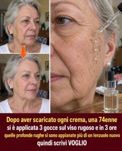 Queste 3 gocce notturne attenuano le rughe profonde del viso all’alba.