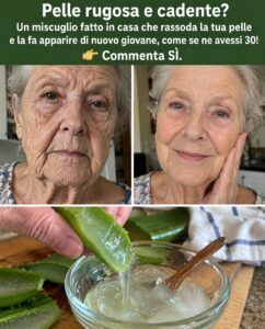 Rughe intorno alla bocca: cosa provocano l’olio di cocco e l’aloe vera sotto la pelle