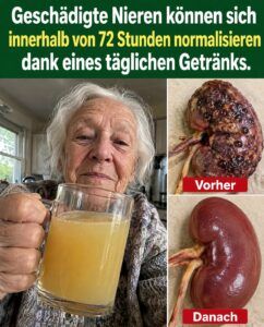 Der Zitronenwasser-Trend, der die Nieren vor dem Frühstück entlastet