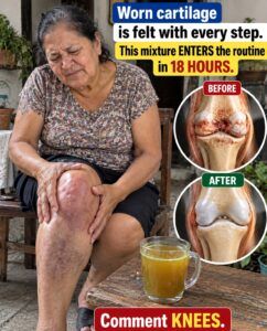 Worn cartilage isn’t silent: here’s how to relieve knee stiffness