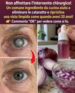 Dormi con la cipolla rossa, svegliati con una vista più nitida