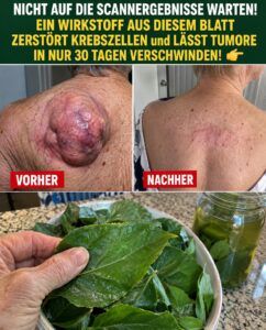 Oregano löst eine zelluläre Reinigung aus, die Ihre Lunge, Haut und Tumore nicht ignorieren können.