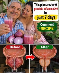 Red onion triggers a dramatic change in an inflamed prostate