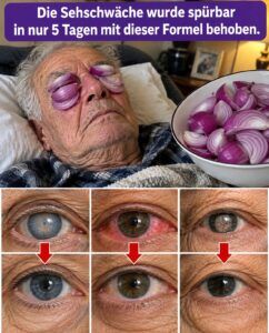 Trübes Sehen und dunkle Augenringe: Was rote Zwiebeln in den Augen auslösen