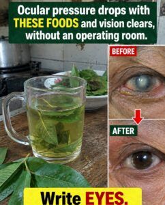 Foods that help control eye pressure and keep your vision more comfortable