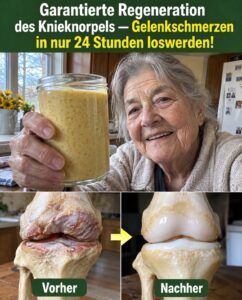 Die Knorpelreparatur im Knie beginnt mit dem versteckten Kollagenschub in Knochenbrühe.