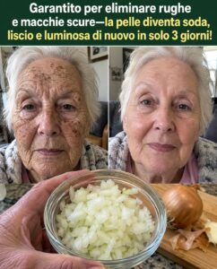 La cipolla rossa fa regredire rughe e macchie scure