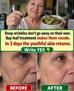 Can bay leaves erase deep wrinkles in 3 days?