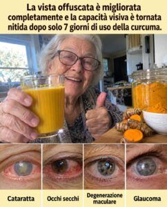 La curcuma innesca un processo di recupero notturno degli occhi che ti mancava