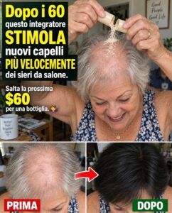Dopo i 60 anni, la caduta dei capelli si fermerà se questa vitamina diventerà la tua ancora di salvezza.