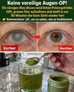 Grauer Star und verschwommenes Sehen: Der Spinat-und-Ei-Trick, der die Linse schärft