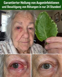 Rote, verschwommene Augen? Eyebright sorgt in 10 Minuten für eine schnelle Erholung.
