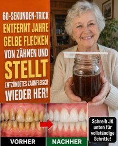 Dieser Trick gegen Zahnverfärbungen über Nacht sorgt heute für weißere Zähne und dauerhaft dünneren Zahnschmelz.