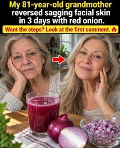 Can red onion tighten sagging skin in just 3 days?