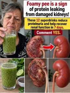 Foam in urine: a sign that damaged kidneys can no longer hide it.