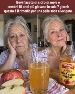 Un aspetto più fresco di 10 anni: il trucco per rigenerare la pelle con l’aceto di mele.