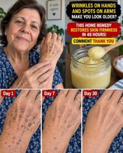 Smooth Hands and Blemish-Free Arms: The Home Remedy That Awakens Tired Skin