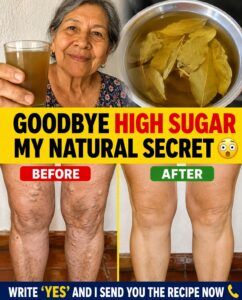 The essential vitamin to relieve leg and bone pain.