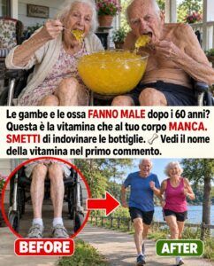Gambe e ossa doloranti? Al tuo corpo manca questa vitamina