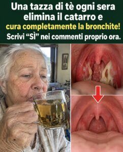 Zenzero, limone e miele possono sciogliere il muco in 2 giorni?