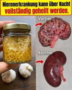 Nierenschäden verschwunden? Was Petersilie, Zitrone und Ingwer in Ihren Nieren bewirken