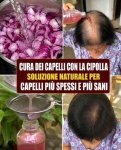 L’olio di cipolla per il cuoio capelluto rivitalizza i capelli che cadono e riempie le zone diradate.