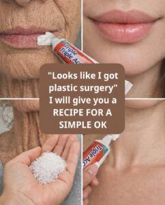 “It Looks Like I Had Cosmetic Surgery”: The Home Remedy Many People Use to Improve the Appearance of Wrinkles and Age Spots on Their Hands and Arms