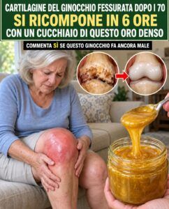 Dopo i 65 anni, le articolazioni rigide e doloranti rendono le scale un’impresa titanica: questo cucchiaio denso cambia tutto.