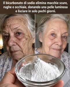 Il bicarbonato di sodio può eliminare macchie scure, rughe e occhiaie: ecco il trucco.