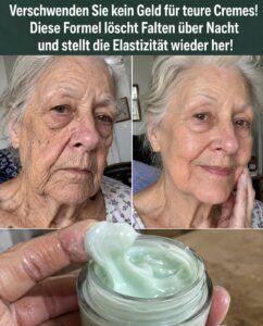 Falten um den Mund: Was Kokosöl und Aloe Vera unter der Haut auslösen