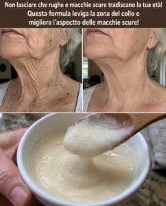 Le rughette del collo si sciolgono quando questa pasta che trovi in ​​dispensa entra in contatto con la pelle