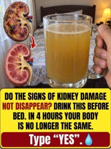Do Your Kidneys Wake You Up Several Times at Night? Discover This Homemade Habit