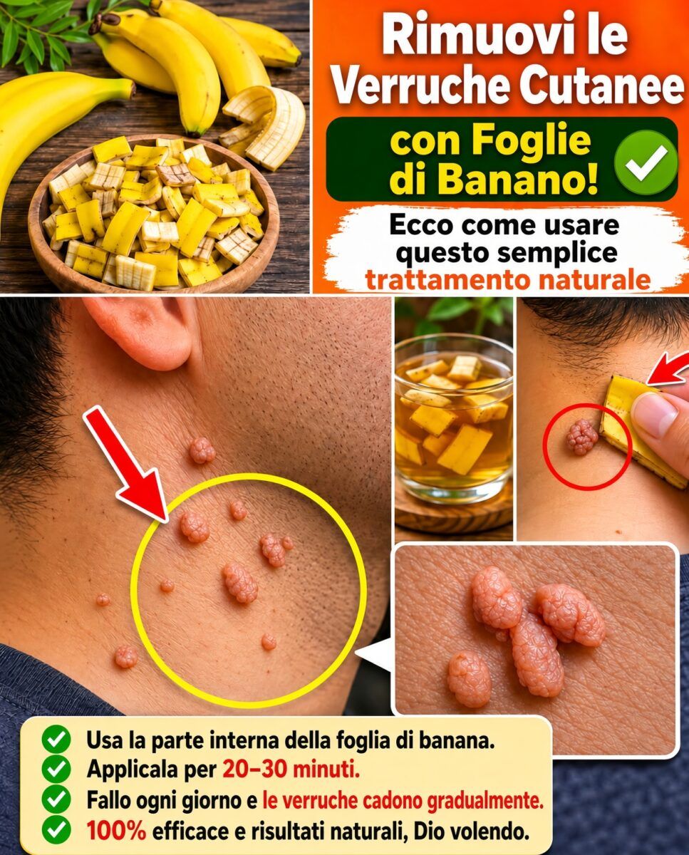 Verruche cutanee: come rimuoverle con le foglie di banano