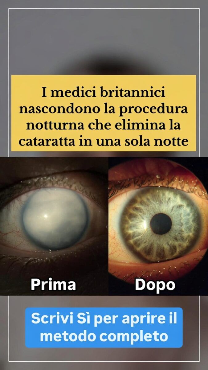 Cataratta e salute degli occhi