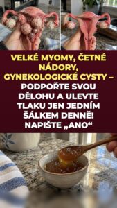 Děložní myomy a cysty na vaječnících: co zázvor a kurkuma spouštějí ve vaší pánvi