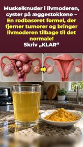Tryk i bækkenet efter 45? En gurkemeje-ingefærdrik sætter gang i en nulstilling af underlivet