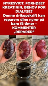Dette middel udløser en nyreskylning, der ændrer alt for din urin