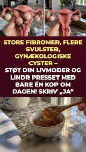 Fibromer og cyster på æggestokkene: Hvad ingefær og gurkemeje sætter i gang i dit bækken