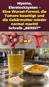 Beckendruck ab 45? Ein Kurkuma-Ingwer-Getränk löst einen Neustart im Unterleib aus