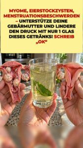 Myom- und Zystendruck: Was dieser grüne Sud auslöst
