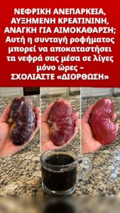 Αυτή η θεραπεία πυροδοτεί έναν καθαρισμό των νεφρών που αλλάζει τα πάντα στα ούρα