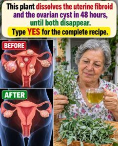 This Plant Dissolves Uterine Fibroids and Ovarian Cysts? The 48-Hour Claim Examined