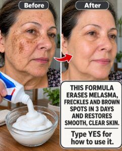 This Formula Erases Melasma in 3 Days? The Skin Claim Examined