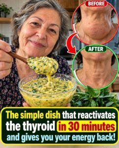 The Dish That Re-ignites the Thyroid in 30 Minutes? The Claim Examined