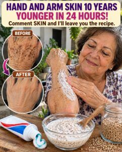 This Preparation Erases Wrinkles and Spots from Hands and Arms in 24 Hours