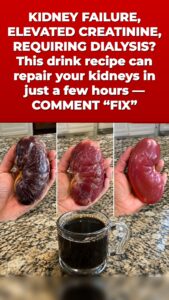 This Remedy Triggers a Kidney Flush That Changes the Urine Game