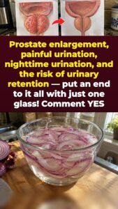 Soaked Red Onion for Prostate Pressure and 2 A.M. Bathroom Trips